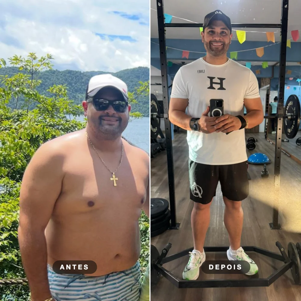 Gustavo Lamas, antes e depois